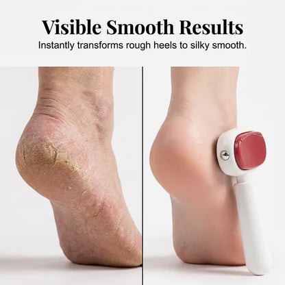 Double-Sided Foot Scraper for Callus Removal - 11