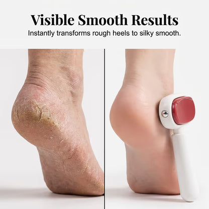 Double-Sided Foot Scraper for Callus Removal - 5