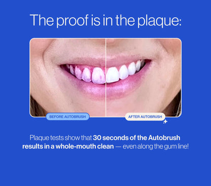 U-shaped electric soft-bristled toothbrush